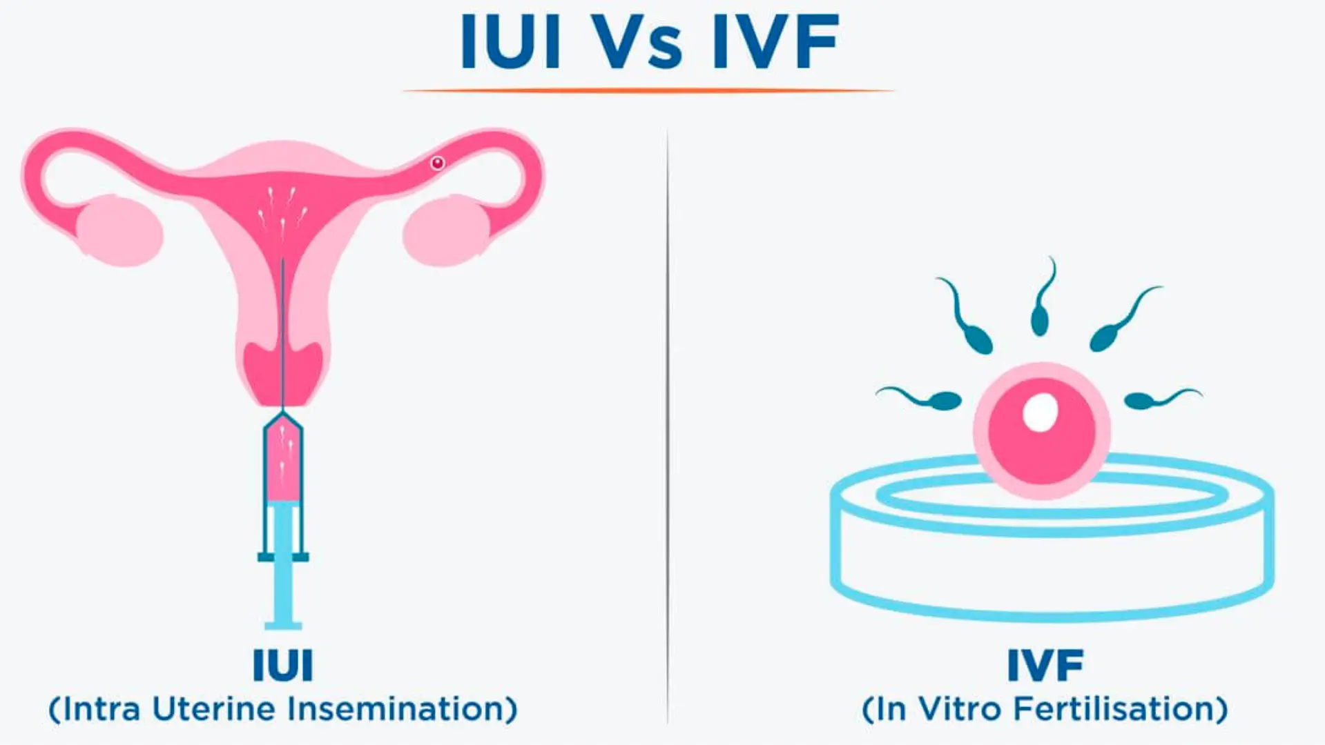 IVF vs IUI Explained: सही Treatment कैसे चुनें?