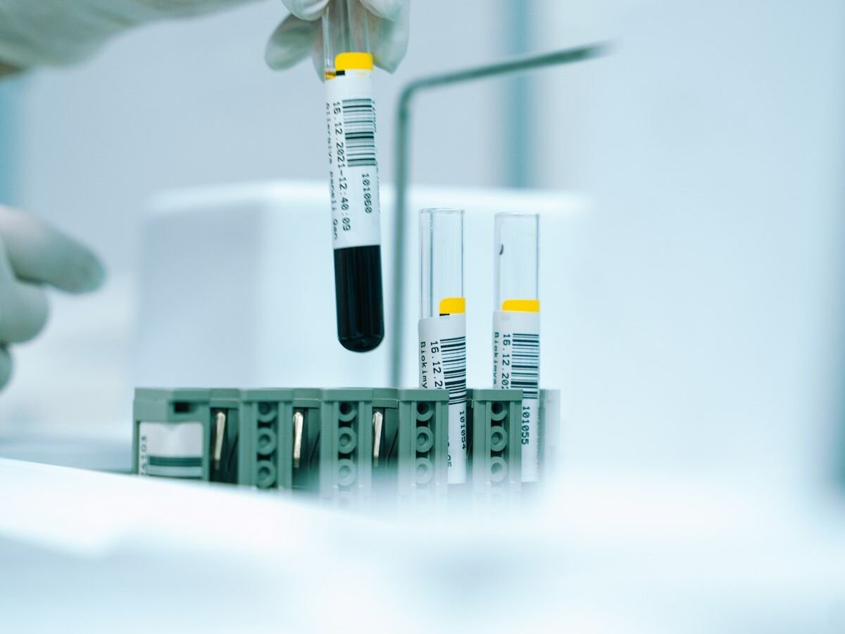 Pediatric Diagnostic Testing