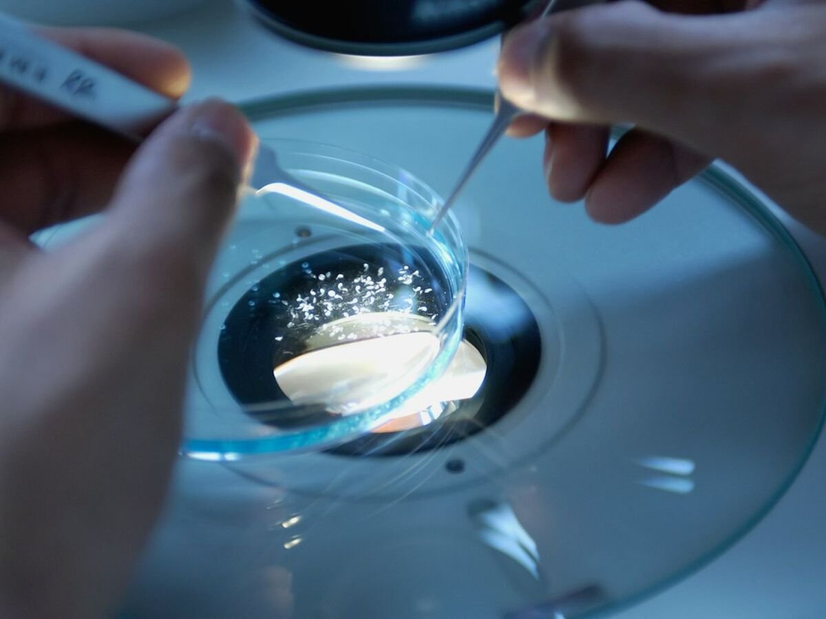 IVF Treatment